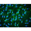 Human_Bone Marrow-derived Mesenchymal Stem Cells (HMSC-bm) - Immunostaining for CD90, 200x.
