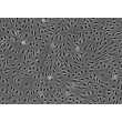 Human Brain Microvascular Endothelial cells (HBMEC) - Phase contrast, 100x.
