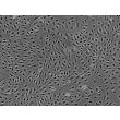 Human Brain Microvascular Endothelial cells (HBMEC) - Phase contrast, 100x.
