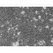 Human Bronchial Epithelial Cells-adult (HBEpiC-a) - Phase contrast 100x