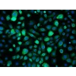 Human Bronchial Epithelial Cells-adult (HBEpiC-a) - Immunostaining for CK-18 200x