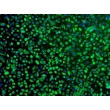 Human Bronchial Epithelial Cells (HBEpiC) - Immunostaining for CK-18, 100x.
