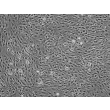 Human Calvarial Osteoblasts (HCO) - Phase contrast, 100x.
