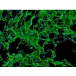 Human Calvarial Osteoblasts (HCO) - Immunostaining for Fibronectin, 200x.

