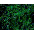 Human Cardiac Fibroblasts (HCF) - Immunostaining for Fibronectin, 100x.
