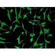 Human Cardiac Fibroblasts-adult (HCF-a) - Immunostaining for Vimentin, 200x.
