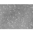 Human Cardiac Fibroblasts-fetal atrial (HCF-fa) - Phase contrast, 100x.
