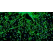 Human Cardiac Fibroblasts-fetal atrial (HCF-fa) - Immunostaining for Fibronectin, 100x.
