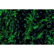 Human Cardiac Fibroblasts-juvenile ventricular (HCF-av) - Immunostaining for Fibronectin, 100x.