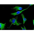Human Cardiac Fibroblasts (HCF) - Immunostaining for Vimentin, 600x..