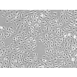Human Cardiac Microvascular Endothelial Cells (HCMEC) - Phase contrast, 100x.