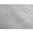 Human Cardiac Microvascular Endothelial Cells (HCMEC) - Phase contrast, 100x.