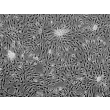 Human Cardiac Myocytes (HCM)-Phase contrast, 100x