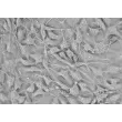 Human Cardiac Myocytes (HCM)-Relief contrast, 400x