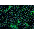 Human Cardiac Myocytes-adult (HCM-a) - Immunostaining for Sarcomeric α-Actinin, 100x.