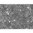 Human Cervical Epithelial Cells (HCerEpiC)-Phase Contrast, 100x.
