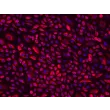 Human Cervical Epithelial Cells (HCerEpiC)-Immunostaining for CK-18, 200x.
