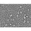 Human Chorionic Mesenchymal Stromal Cells (HCMSC) - Phase contrast, 200x.
