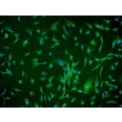 Human Chorionic Mesenchymal Stromal Cells (HCMSC) - Immunostaining for CD105, 200x.
