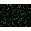 Human Colonic Epithelial Cells (HCoEpiC) - Immunostaining for CK-18, 100x.
