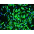Human Coronary Artery Endothelial Cells (HCAEC) - Immunostaining for vWF, 200x.
