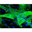 Human Coronary Artery Smooth Muscle Cells (HCASMC)-Immunostaining for α-SMA, 400x