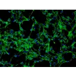 Human_Dermal_Fibroblasts-adult (HDF-a) - Immunostaining for Fibronectin, 200x.
