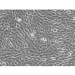 Human Dermal Fibroblasts-fetal (HDF-f) - Phase contrast, 200x.
