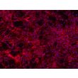 Human Dermal Fibroblasts-GFP (2310-GFP) – immunostaining for Fibronectin 200x