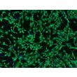 Human Dermal Fibroblasts-GFP (2310-GFP) – GFP fluorescence and Hoechst 100x