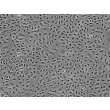 Human Dermal Microvascular Endothelial Cells (HDMEC) - Phase contrast, 100x.
