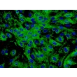 Human Dermal Microvascular Endothelial Cells (HDMEC) - Immunostaining for vWF, 400x.
