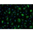 Human Dural Microvascular Endothelial Cells - Immunostaining for vWF, 200X
