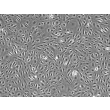 Human Dural Microvascular Endothelial Cells - Phase Contrast, 100X
