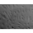 Human Endometrial Microvascular Endothelial Cells (HEMEC)-Relief Contrast, 400x
