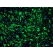 Human Endometrial Microvascular Endothelial Cells (HEMEC)-Immunostaining for vWF, 200x.
