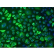 Human Epidermal Keratinocytes-adult (HEK-a) - Immunostaining for CK-18, 100x.
