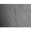 Human Epidermal Keratinocytes-fetal (HEK-f) - Relief contrast, 100x.
