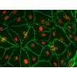 Human Esophageal Endothelial Cells (HEEC) - Immunostaining for CD31, 400x.
