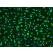 Human Esophageal Endothelial Cells (HEEC) - Immunostaining for vWF, 200x.
