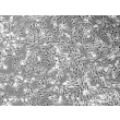 Human Esophageal Smooth Muscle Cells (HESMC) - Phase contrast, 100x.
