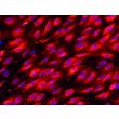 Human Gallbladder Vascular Endothelial Cells (HGBVEC)-Immunostaining for vWF, 400x