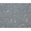 Human Gallbladder Vascular Endothelial Cells (HGBVEC)-Phase Contrast, 100X
