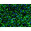Human Gallbladder Vascular Endothelial Cells (HGBVEC)-Immunostaining for CD31, 400x