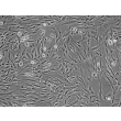 Human Hair Dermal Papilla Cells (HHDPC) - Phase contrast, 100x.
