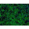 Human Hair Outer Root Sheath Cells (HHORSC) - Immunostaining for Fibronectin, 100x.
