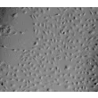 Human Hepatic Sinusoidal Endothelial Cells (HHSEC) - Relief contrast, 100x.
