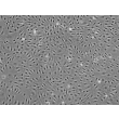 Human Hepatic Sinusoidal Endothelial Cells (HHSEC) - Phase contrast, 100x.
