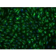 Human Hepatic Sinusoidal Endothelial Cells (HHSEC) - Immunostaining for vWF, 200x
