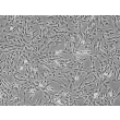 Human Hepatic Stellate Cells (HHSteC) - Phase contrast, 100x.
